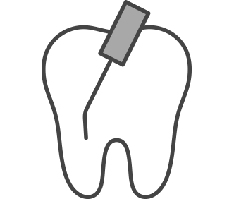 歯内療法・根管治療