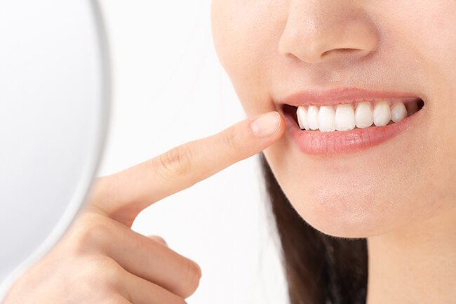 ホワイトニングについて